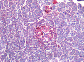 SST/Somatostatin Antibody