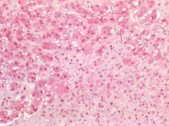 MYC/c-Myc Antibody