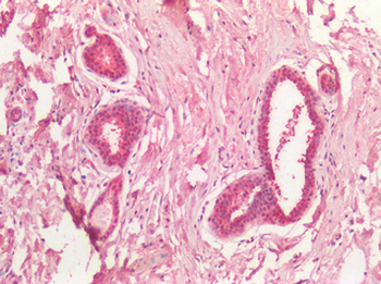 MYC/c-Myc Antibody