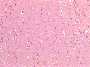 CD81 Antibody