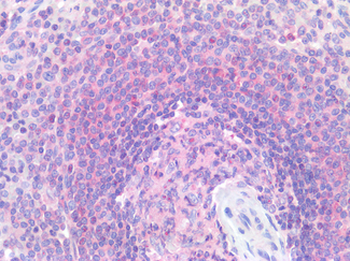 CD33 Antibody