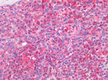CD33 Antibody