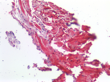 ROR1 Antibody