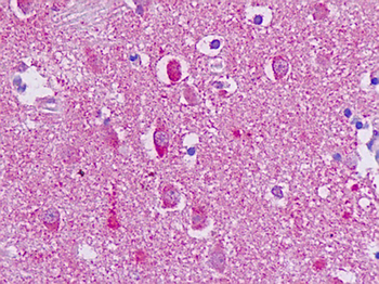 ADGRG1/GPR56 Antibody