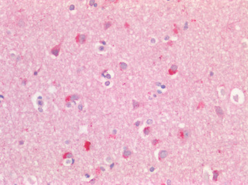 GPR49/LGR5 Antibody