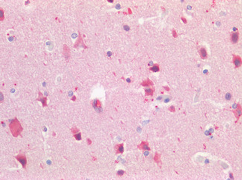 GPR49/LGR5 Antibody