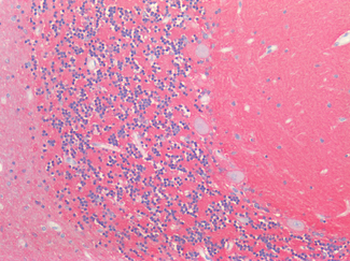 NCAM/CD56 Antibody