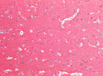 MAPT/Tau Antibody