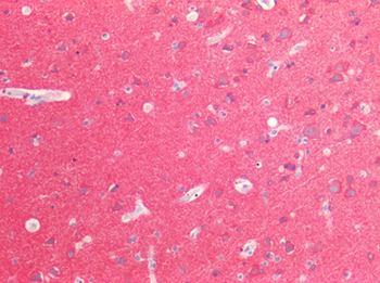 MAPT/Tau Antibody