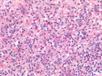ITGAM/CD11b Antibody