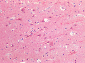 ACHE/Acetylcholinesterase Antibody