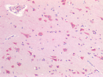 ACHE/Acetylcholinesterase Antibody