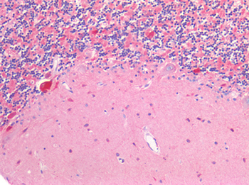 SLC17A7/VGLUT1 Antibody