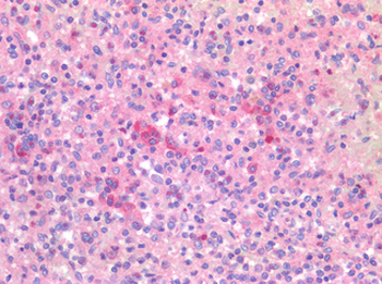 CD40 Antibody