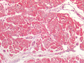 BMP4 Antibody