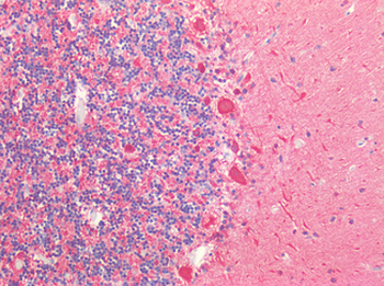 UCHL1/PGP9.5 Antibody