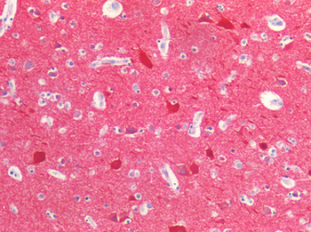 NEFH/NF-H Antibody
