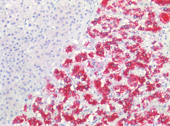 GRIN1/NMDAR1 Antibody