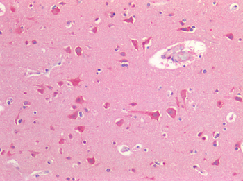 NOS1/nNOS Antibody