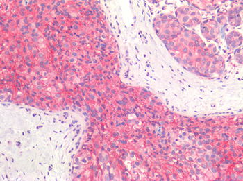 ERBB2/HER2 Antibody