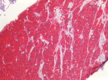 ERBB2/HER2 Antibody