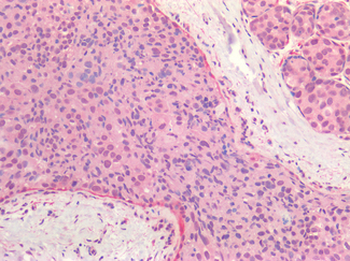 ER Alpha/Estrogen Receptor Antibody