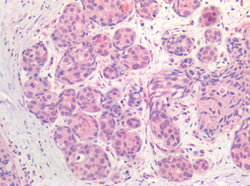 ER Alpha/Estrogen Receptor Antibody