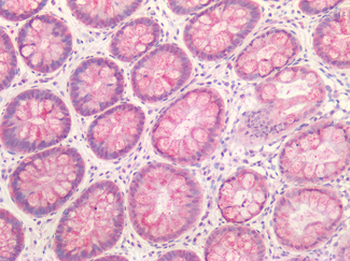 IL23A/IL-23 p19 Antibody