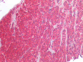 ERBB2/HER2 Antibody