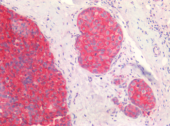 ERBB2/HER2 Antibody