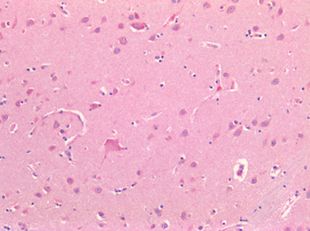 ADORA2A/Adenosine A2A Receptor Antibody
