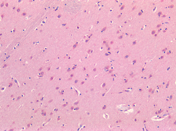 ADORA2A/Adenosine A2A Receptor Antibody