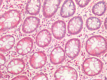 HGF/Hepatocyte Growth Factor Antibody