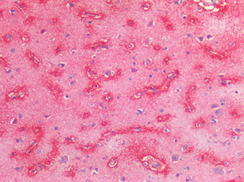 MYC/c-Myc Antibody