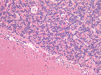 IGF1R/IGF1 Receptor Antibody