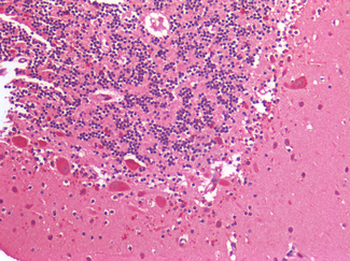 IGF1R/IGF1 Receptor Antibody