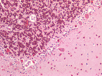 IGF1R/IGF1 Receptor Antibody