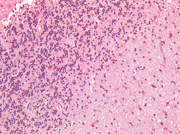 IGF1R/IGF1 Receptor Antibody