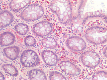 CASP3/Caspase 3 Antibody