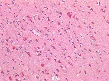 ROR1 Antibody
