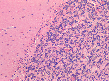 ROR1 Antibody