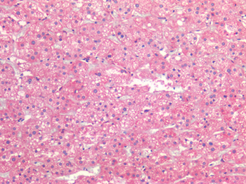 ALK2/ACVR1 Antibody