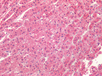 ALK2/ACVR1 Antibody