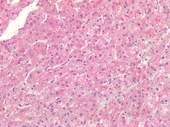 ALK2/ACVR1 Antibody