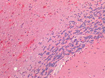 NRN1/Neuritin Antibody