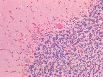 NRN1/Neuritin Antibody
