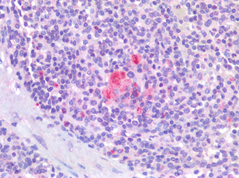 IL4 Antibody