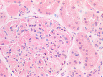FOXC1 Antibody