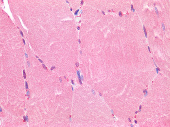 FOXC1 Antibody