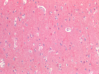 CD81 Antibody